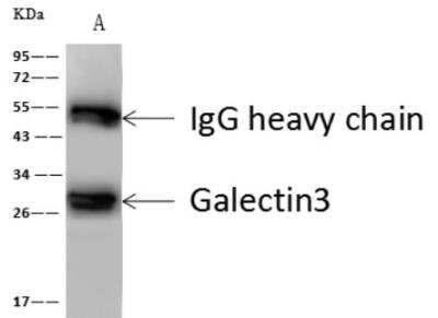 Immunoprecipitation: Galectin-3 Antibody (024) [NBP2-89383]