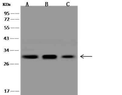 Western Blot: Galectin-3 Antibody (024) [NBP2-89383]