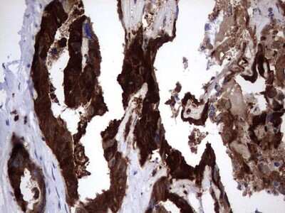 Immunohistochemistry: Galectin-3 Antibody (OTI1C7) [NBP2-45618]