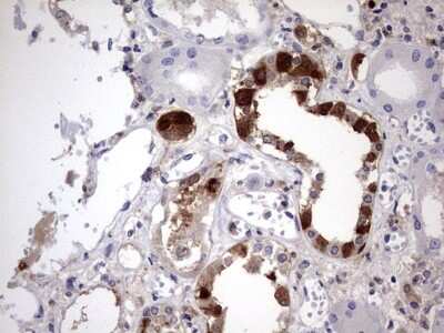 Immunohistochemistry: Galectin-3 Antibody (OTI1C7) [NBP2-45618]