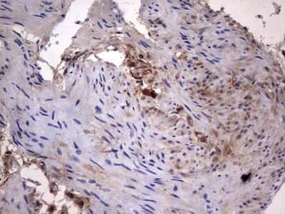 Immunohistochemistry: Galectin-3 Antibody (OTI1C7) [NBP2-45618]