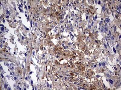 Immunohistochemistry: Galectin-3 Antibody (OTI1C7) [NBP2-45618]