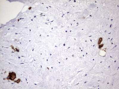 Immunohistochemistry: Galectin-3 Antibody (OTI1C7) [NBP2-45618]