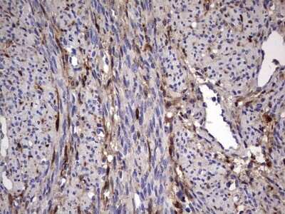 Immunohistochemistry: Galectin-3 Antibody (OTI1C7) [NBP2-45618]