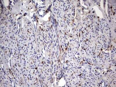 Immunohistochemistry: Galectin-3 Antibody (OTI1C7) [NBP2-45618]