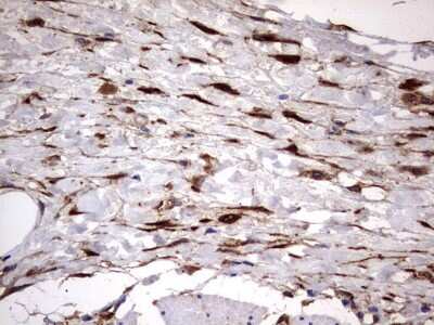 Immunohistochemistry: Galectin-3 Antibody (OTI1C7) [NBP2-45618]