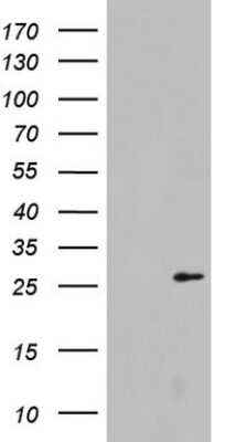 Western Blot: Galectin-3 Antibody (OTI1C7) [NBP2-45618]