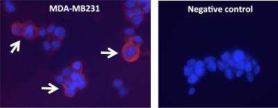 Immunocytochemistry/ Immunofluorescence: Galectin-3 Antibody (5C21) [NBP1-92690]