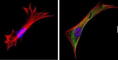 Immunocytochemistry/ Immunofluorescence: Galectin-3 Antibody (A3A12) - BSA Free [NB300-538]