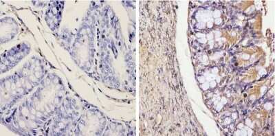 Immunohistochemistry-Paraffin: Galectin-3 Antibody (A3A12) - BSA Free [NB300-538]