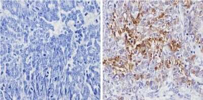 Immunohistochemistry-Paraffin: Galectin-3 Antibody (A3A12) - BSA Free [NB300-538]