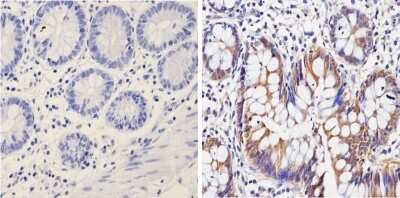 Immunohistochemistry-Paraffin: Galectin-3 Antibody (A3A12) - BSA Free [NB300-538]