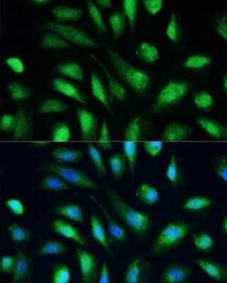 Immunocytochemistry/ Immunofluorescence: Galectin-3 Antibody - Azide and BSA Free [NBP3-03252]