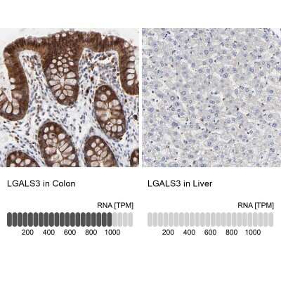 Immunohistochemistry-Paraffin: Galectin-3 Antibody [NBP1-89795]