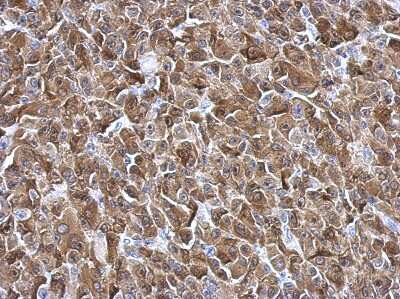 Immunohistochemistry-Paraffin: Galectin-3 Antibody [NBP2-16589]