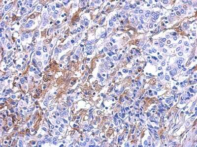 Immunohistochemistry-Paraffin: Galectin-3 Antibody [NBP2-16590]