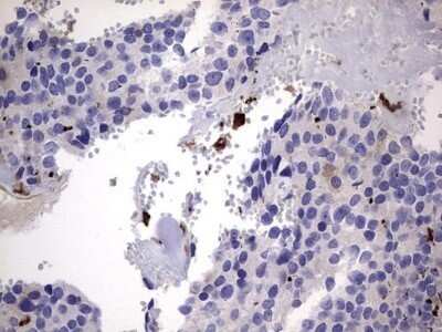 Immunohistochemistry: Galectin-3 Antibody (OTI1C7) - Azide and BSA Free [NBP2-71124]