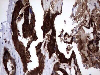 Immunohistochemistry: Galectin-3 Antibody (OTI1C7) - Azide and BSA Free [NBP2-71124]