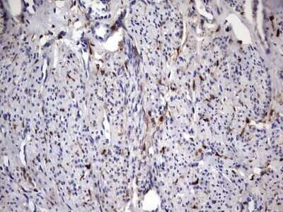 Immunohistochemistry: Galectin-3 Antibody (OTI1C7) - Azide and BSA Free [NBP2-71124]