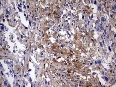 Immunohistochemistry: Galectin-3 Antibody (OTI1C7) - Azide and BSA Free [NBP2-71124]