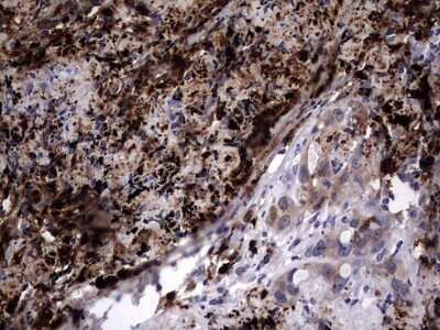 Immunohistochemistry: Galectin-3 Antibody (OTI1C7) - Azide and BSA Free [NBP2-71124]