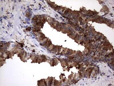 Immunohistochemistry: Galectin-3 Antibody (OTI1C7) - Azide and BSA Free [NBP2-71124]