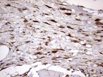 Immunohistochemistry: Galectin-3 Antibody (OTI1C7) - Azide and BSA Free [NBP2-71124]