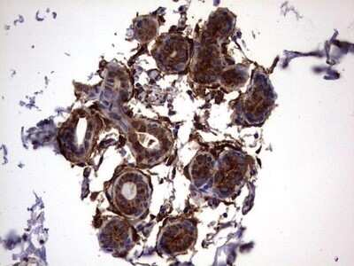 Immunohistochemistry: Galectin-3 Antibody (OTI1C7) - Azide and BSA Free [NBP2-71124]