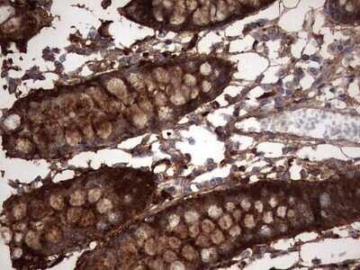 Immunohistochemistry: Galectin-3 Antibody (OTI1C7) - Azide and BSA Free [NBP2-71124]