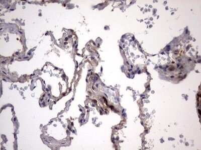 Immunohistochemistry: Galectin-3 Antibody (OTI1C7) - Azide and BSA Free [NBP2-71124]