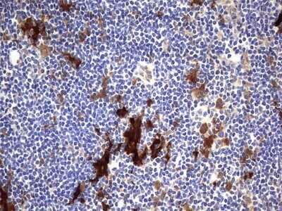 Immunohistochemistry: Galectin-3 Antibody (OTI1C7) - Azide and BSA Free [NBP2-71124]