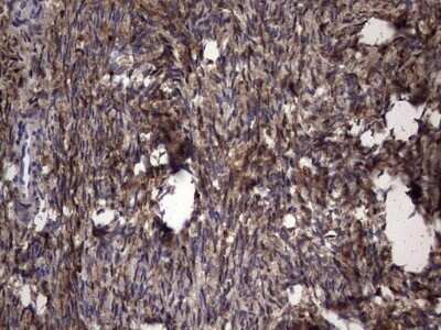 Immunohistochemistry: Galectin-3 Antibody (OTI1C7) - Azide and BSA Free [NBP2-71124]