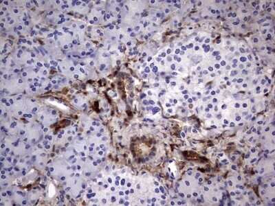 Immunohistochemistry: Galectin-3 Antibody (OTI1C7) - Azide and BSA Free [NBP2-71124]