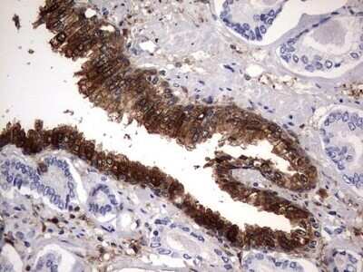 Immunohistochemistry: Galectin-3 Antibody (OTI1C7) - Azide and BSA Free [NBP2-71124]