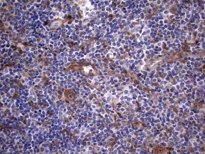Immunohistochemistry: Galectin-3 Antibody (OTI1C7) - Azide and BSA Free [NBP2-71124]