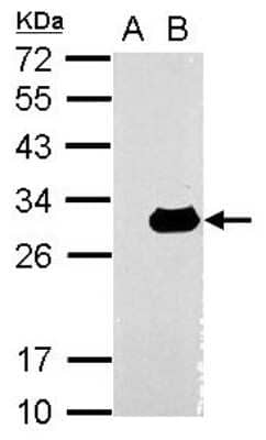 Western Blot: Galectin-3 Antibody [NBP2-16589]