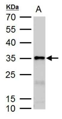 Western Blot: Galectin-3 Antibody [NBP2-16589]