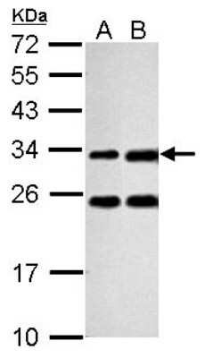 Western Blot: Galectin-3 Antibody [NBP2-16590]