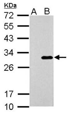 Western Blot: Galectin-3 Antibody [NBP2-16590]
