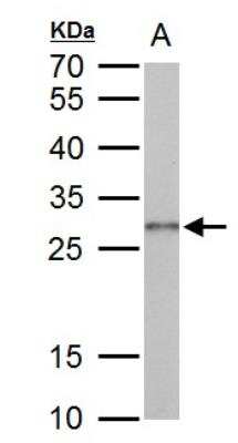 Western Blot: Galectin-3 Antibody [NBP2-16590]