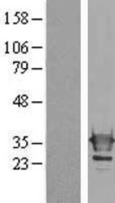 Western Blot: Galectin-3 Overexpression Lysate [NBL1-12501]