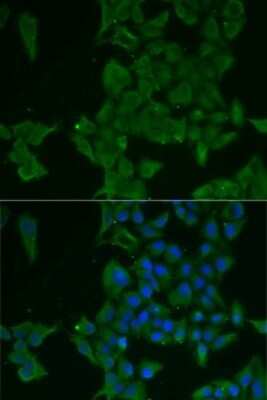 Immunocytochemistry/ Immunofluorescence: Galectin-3BP/MAC-2BP/LGALS3BP Antibody - BSA Free [NBP3-03669]