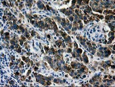 Immunohistochemistry: Galectin-3BP/MAC-2BP/LGALS3BP Antibody (OTI6B7) - Azide and BSA Free [NBP2-71125]