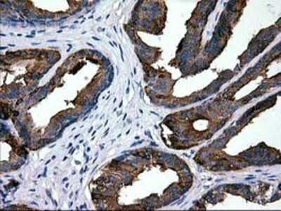Immunohistochemistry: Galectin-3BP/MAC-2BP/LGALS3BP Antibody (OTI6B7) - Azide and BSA Free [NBP2-71125]