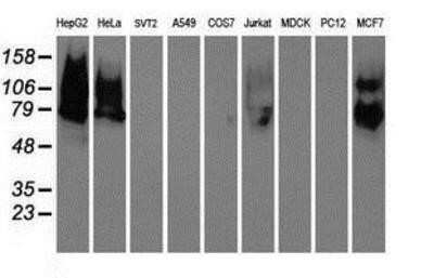 Western Blot: Galectin-3BP/MAC-2BP/LGALS3BP Antibody (OTI6B7)Azide and BSA Free [NBP2-71125]