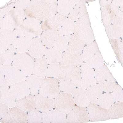 Immunohistochemistry-Paraffin: Galectin-3BP/MAC-2BP/LGALS3BP Antibody [NBP1-89346]