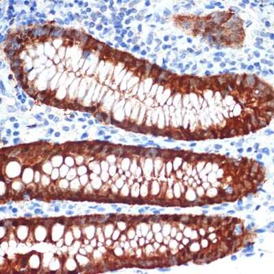 Immunohistochemistry-Paraffin: Galectin-4 Antibody (9Z2B5) [NBP3-16249]