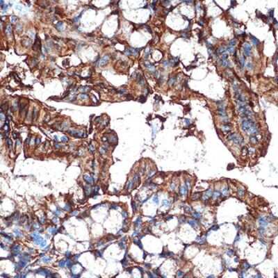 Immunohistochemistry-Paraffin: Galectin-4 Antibody (9Z2B5) [NBP3-16249]