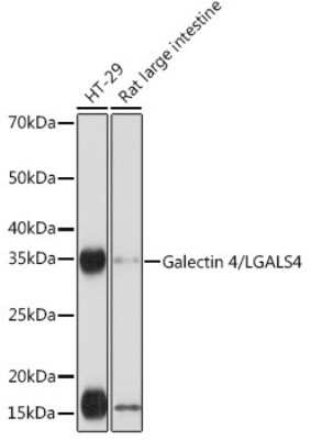 Western Blot: Galectin-4 Antibody (9Z2B5) [NBP3-16249]