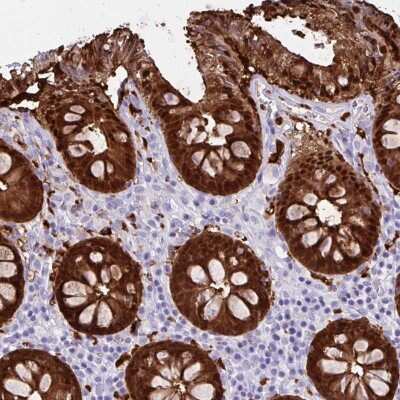 Immunohistochemistry-Paraffin: Galectin-4 Antibody [NBP2-48605]